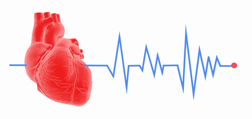 Hình ảnh ECG